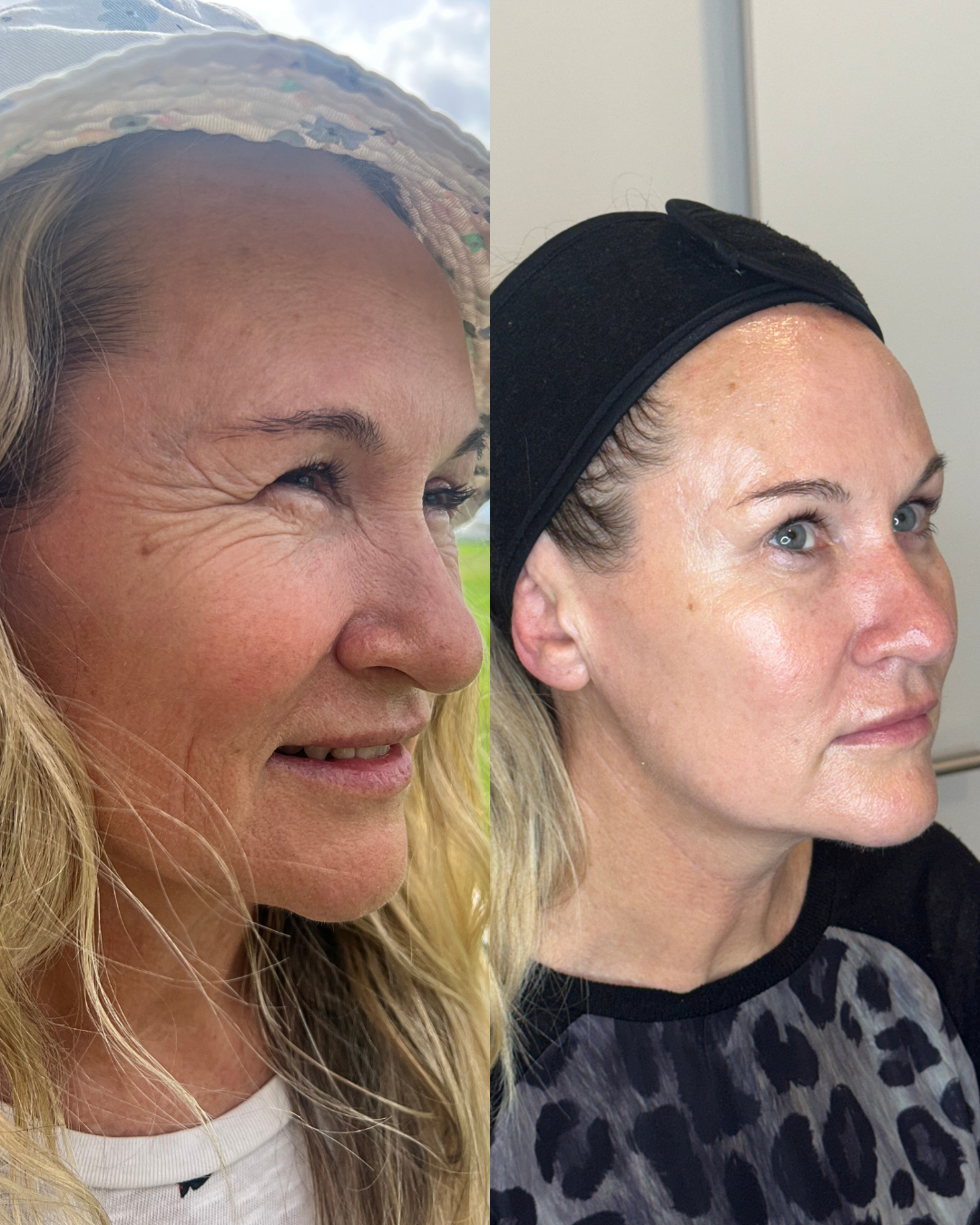 Fairy Flash – New Client Offer $199