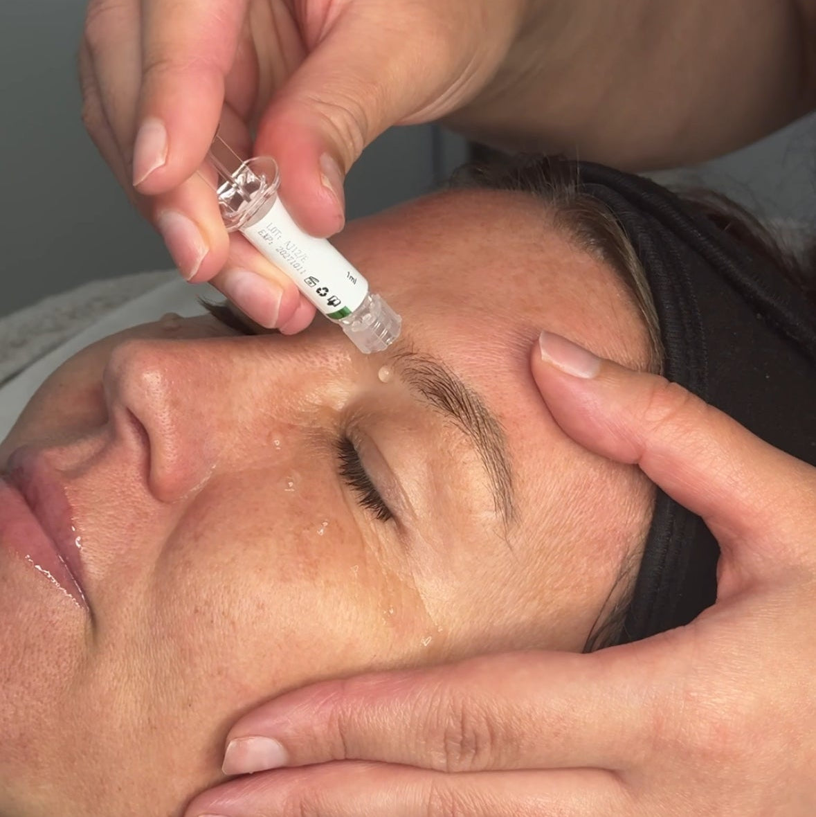 Fairy Dust Facial + FREE Eye Bio-Needling 🧚♀️👁️ (Save 36%)