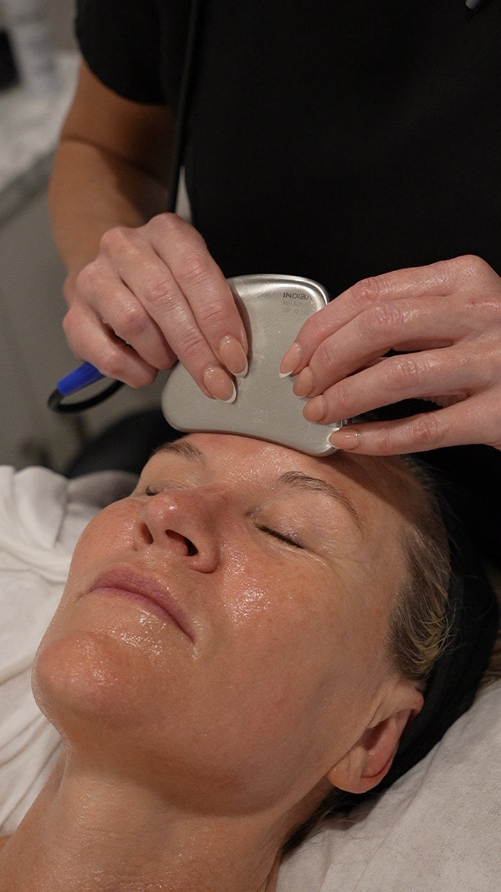 Lifted Fairy treatment at Belaméres