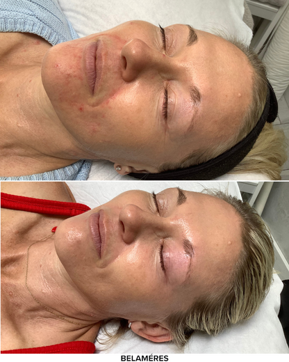 Fairy Dust Pack x4 - BELAMÉRES