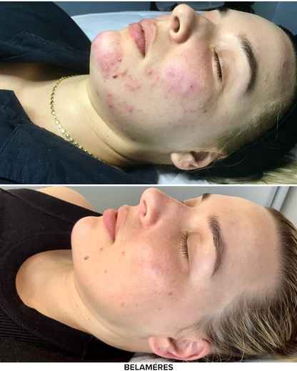 Fairy Dust Pack x6 - BELAMÉRES