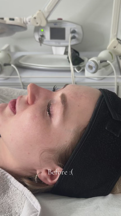 Fairy Dust Facial + Neck Treatment